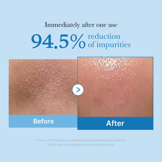 Zero Pore Blackhead Deep Cleansing Oil - Image 3